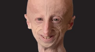 Laura Lucchin e Amerigo Basso presentano il libro Sammy: una vita da abbracciare, con firmacopie